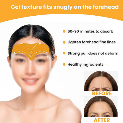 YouthGlow Forehead Wrinkle Patches – Smoothing Anti-Wrinkle Solution